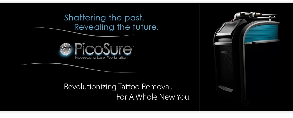 PicoSure laser tattoo removal UK | Laser Tattoo removal options