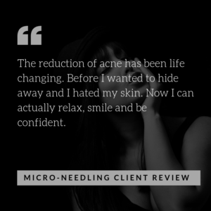 Acne treatments | Microneedling review