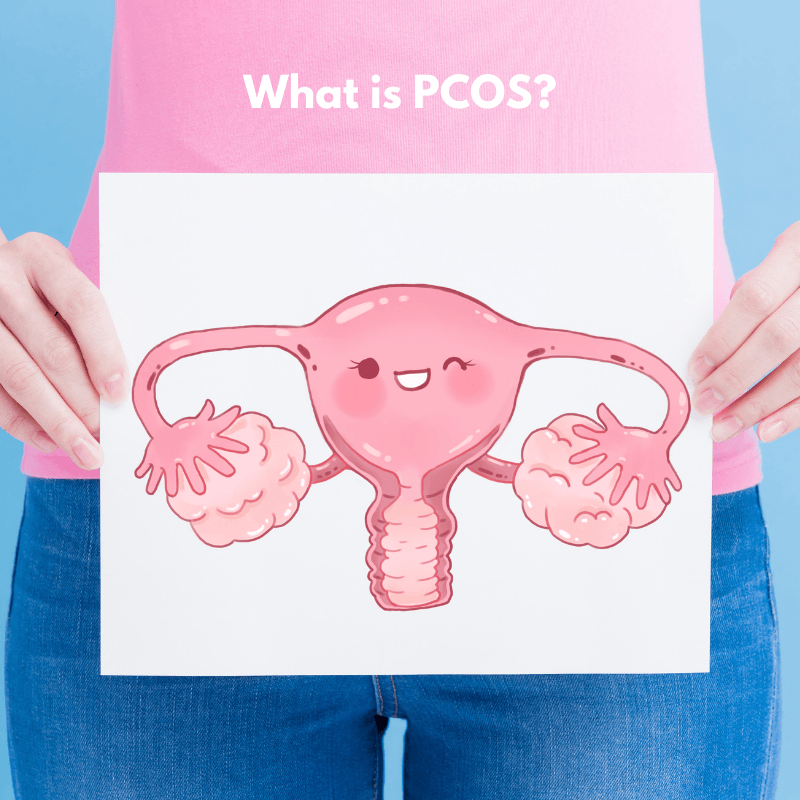 Picture of What is PCOS 