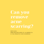 Can you removal acne scarring